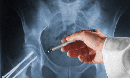 a hand holding a pen