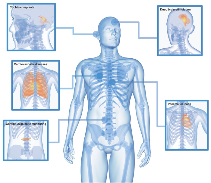 en person med flera bilder av kroppen